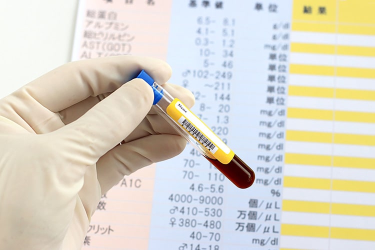 糖尿病について